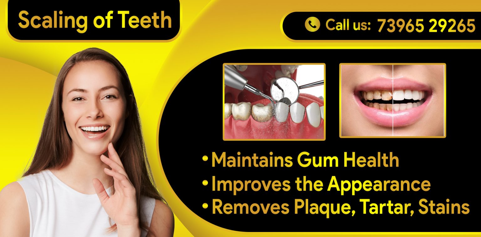 Gum Diseases Treatment Smile Dental And Implant Centre