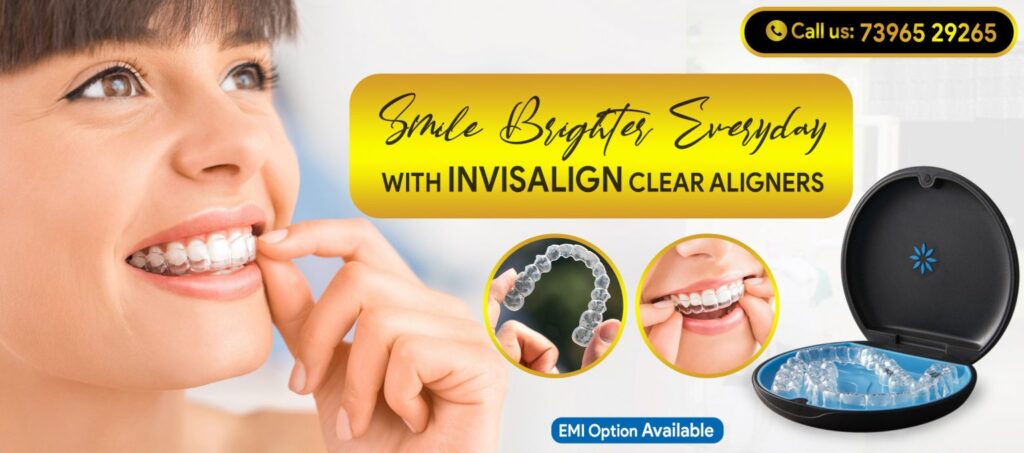 Invisible Clear Braces cost in India by Smile in Hour AHD, BOM, DEL India