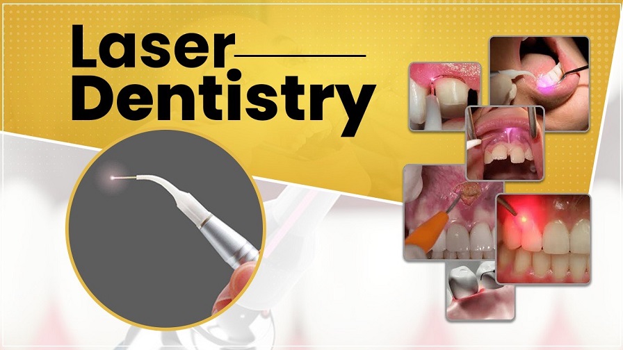 Laser Dentist Near You
