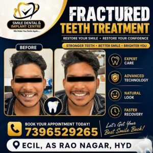 Dental clinic ad with before/after photos of a man showing fractured teeth corrected to a brighter smile; includes phone number and Hyderabad location.