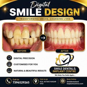 Before-and-after photo showing teeth transformation from Digital Smile Design, with 'Before' and 'After' captions and a central arrow point. Hyper-branded dental ad. (Informative)