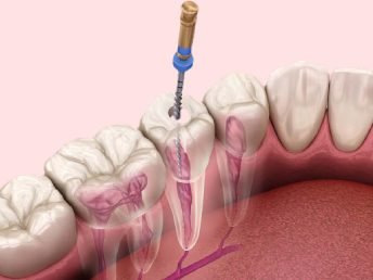 Smile Dental